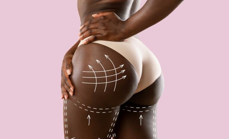  CHIRURGIE ESTHETIQUE : Ces conditions inhérentes qui sont régies par la profession